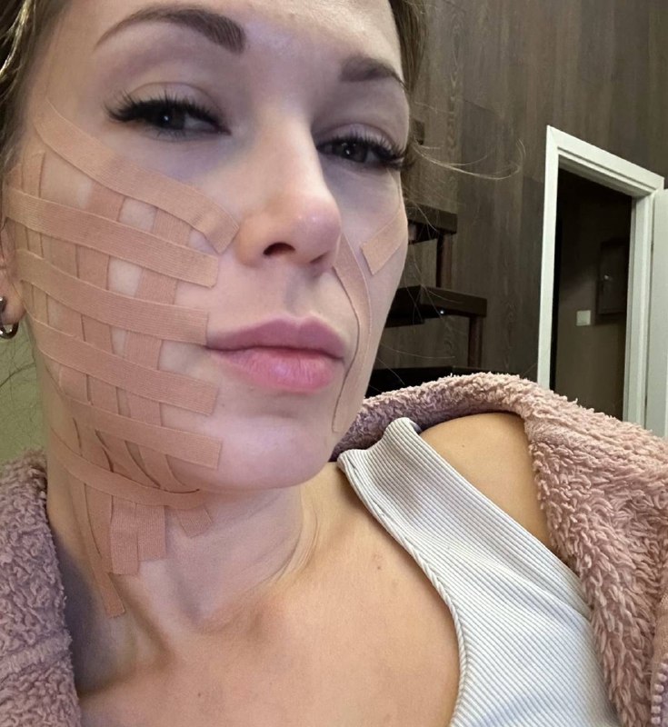 Осваиваю тейпирование. Криво-косо, но как-то они у меня